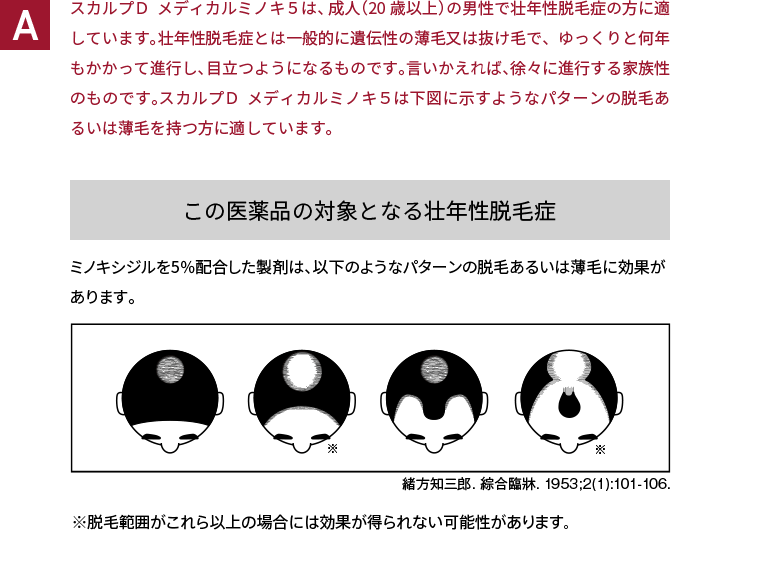 スカルプＤ  メディカルミノキ５は、成人（20歳以上）の男性で壮年性脱毛症の方に適しています。壮年性脱毛症とは一般的に遺伝性の薄毛又は抜け毛で、ゆっくりと何年もかかって進行し、目立つようになるものです。言いかえれば、徐々に進行する家族性のものです。スカルプＤ  メディカルミノキ５は下図に示すようなパターンの脱毛あるいは薄毛を持つ方に適しています。 この医薬品の対象となる壮年性脱毛症 ミノキシジルを5％配合した製剤は、以下のようなパターンの脱毛あるいは薄毛に効果があります。 ※脱毛範囲がこれら以上の場合には効果が得られない可能性があります。
