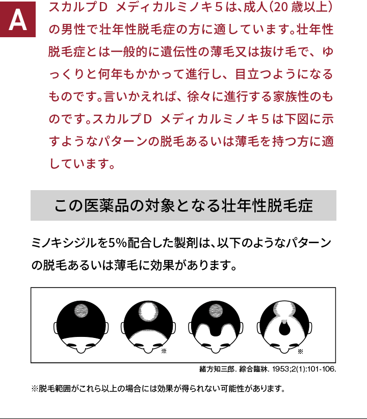 スカルプＤ  メディカルミノキ５は、成人（20歳以上）の男性で壮年性脱毛症の方に適しています。壮年性脱毛症とは一般的に遺伝性の薄毛又は抜け毛で、ゆっくりと何年もかかって進行し、目立つようになるものです。言いかえれば、徐々に進行する家族性のものです。スカルプＤ  メディカルミノキ５は下図に示すようなパターンの脱毛あるいは薄毛を持つ方に適しています。 この医薬品の対象となる壮年性脱毛症 ミノキシジルを5％配合した製剤は、以下のようなパターンの脱毛あるいは薄毛に効果があります。 ※脱毛範囲がこれら以上の場合には効果が得られない可能性があります。