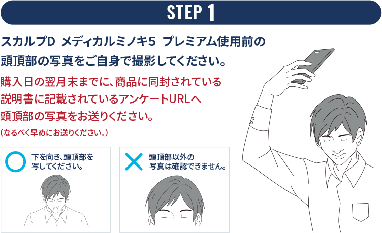 STEP 1 スカルプD  メディカルミノキ５  プレミアム使用前の頭頂部の写真をご自身で撮影してください。