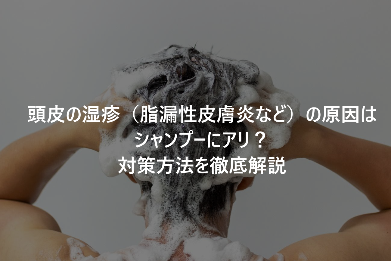 頭皮の湿疹（脂漏性皮膚炎など）の原因はシャンプーにアリ？対策方法を徹底解説