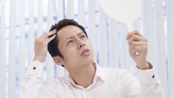 薄毛原因と対策8選！薄毛の原因は遺伝だけではなかった