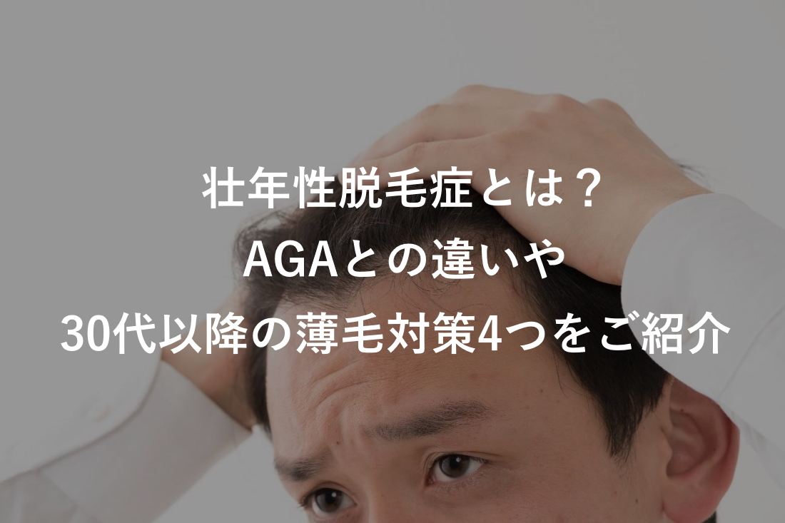 AGAと壮年性脱毛症に違いはあるのか？30代以降の薄毛対策5つのポイント