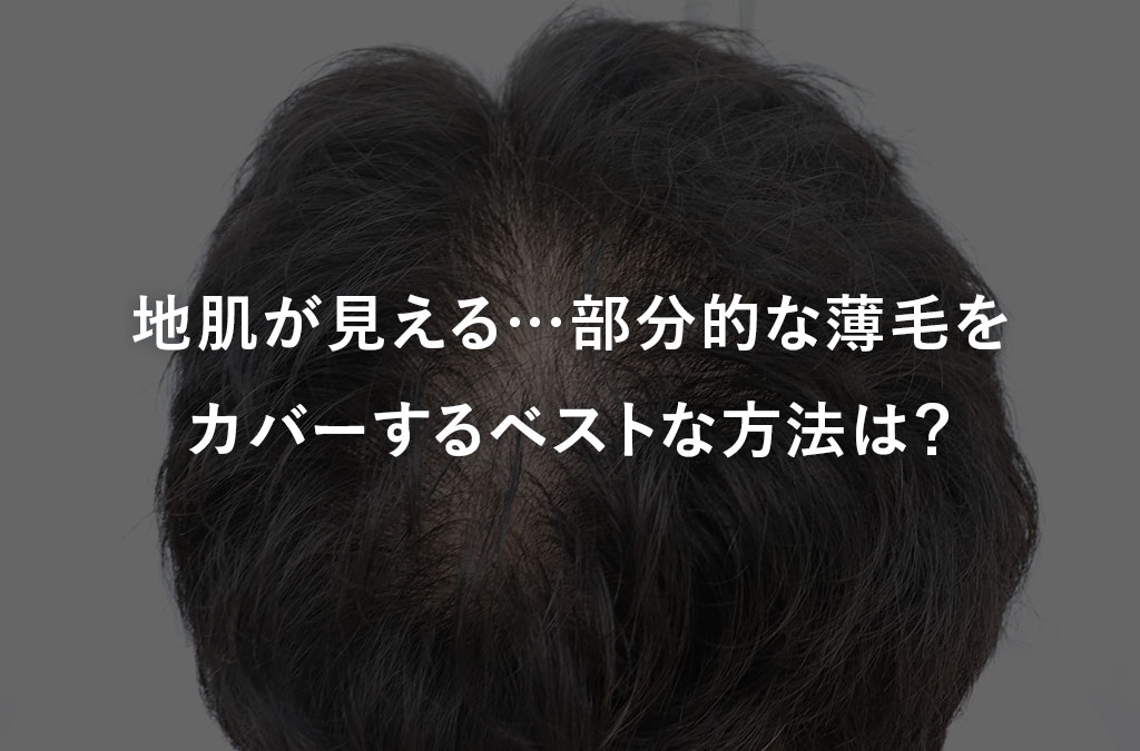 地肌が見える…部分的な薄毛をカバーするベストな方法は？