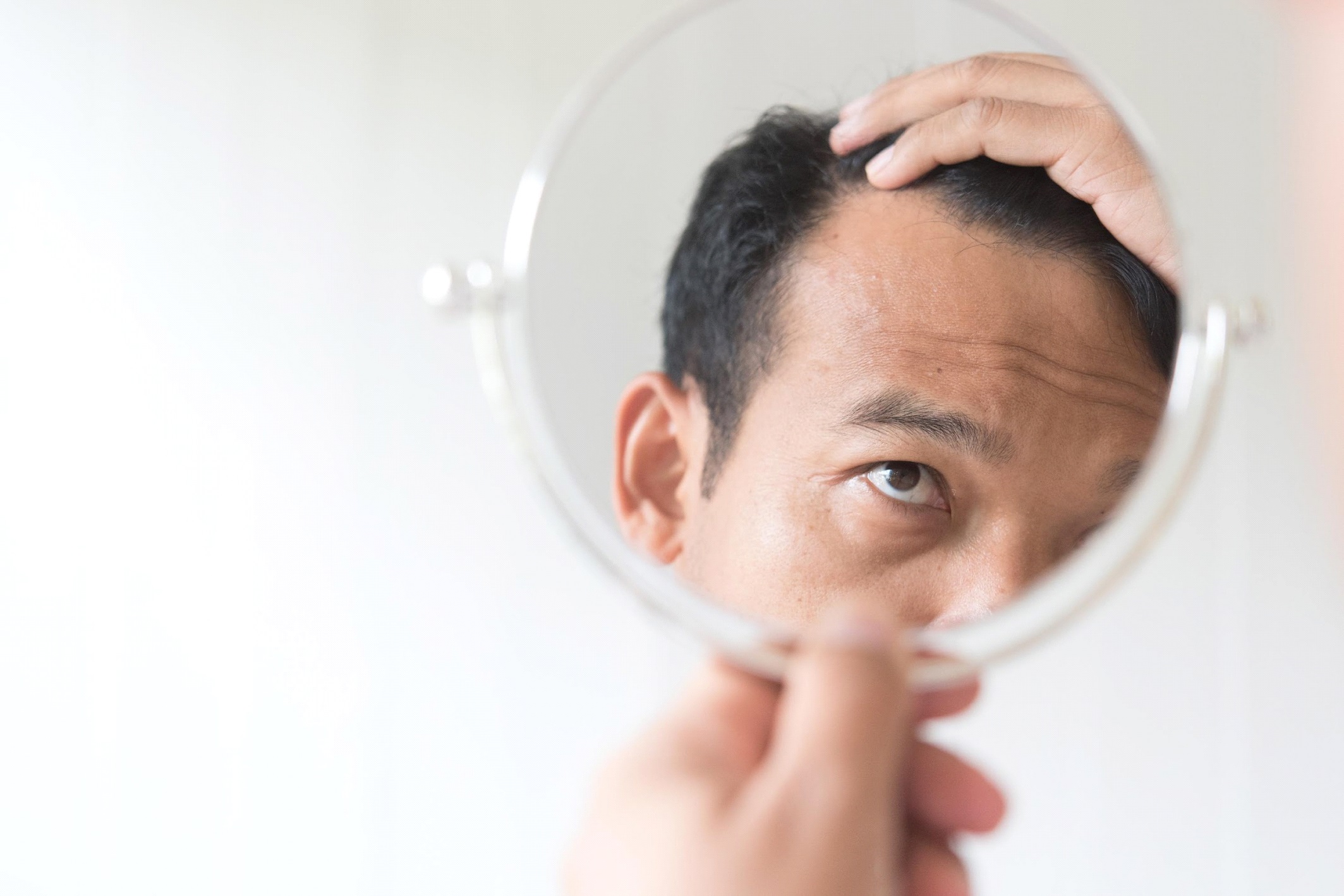 頭皮が敏感になる原因