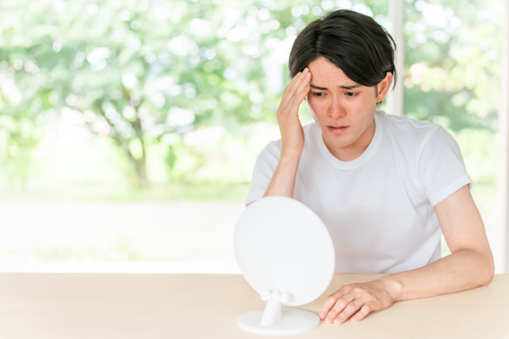 脂漏性皮膚炎は頭皮のカビが主な原因！カビの増殖を防ぐ方法や治し方を解説