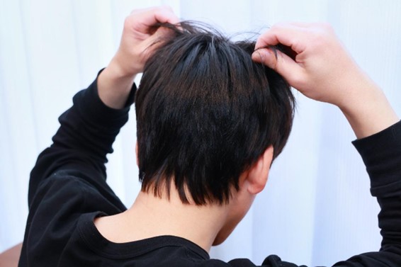 フケ以外も！春に起こりやすい髪・頭皮トラブル