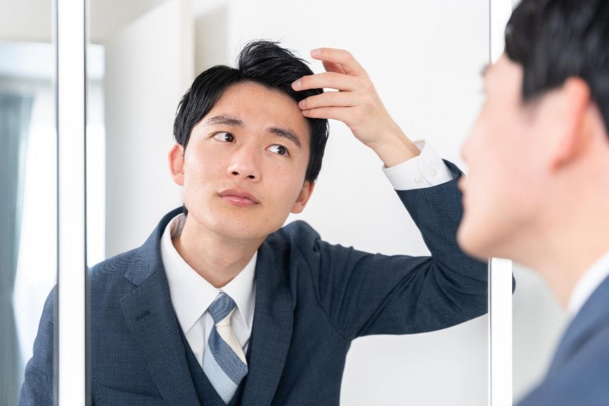 生え際の後退は勘違い？セルフチェック方法とおすすめ薄毛対策を紹介