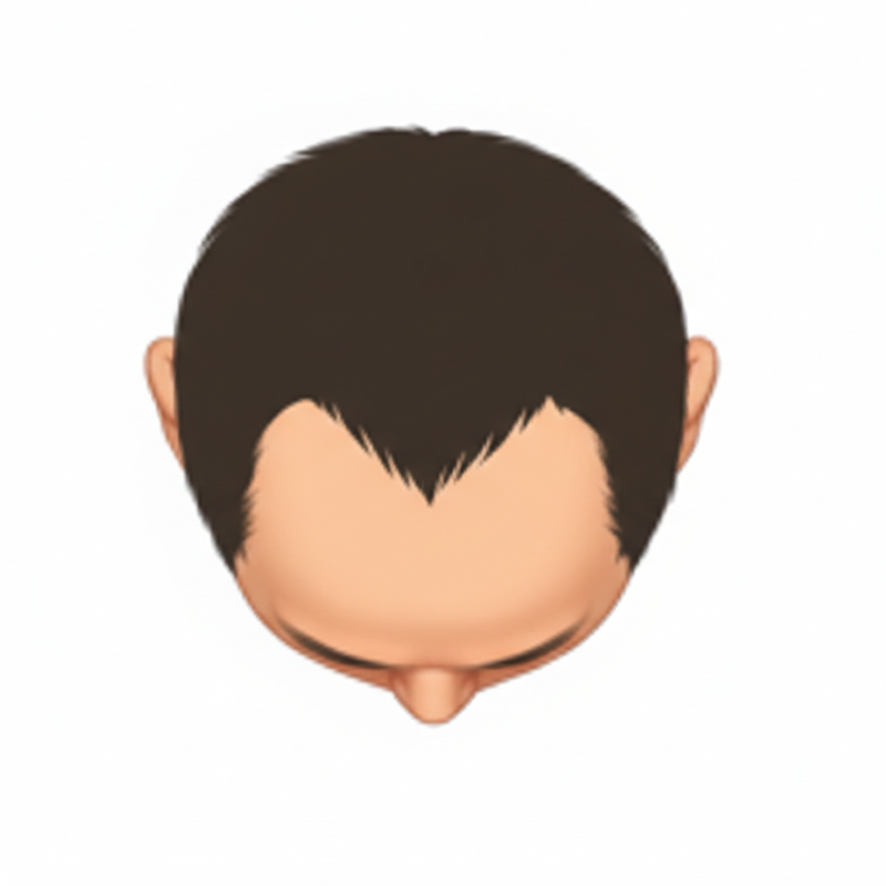 M字型