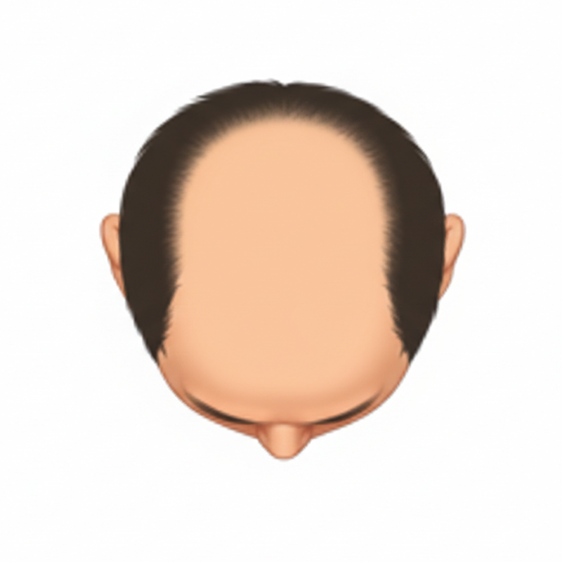 U字型