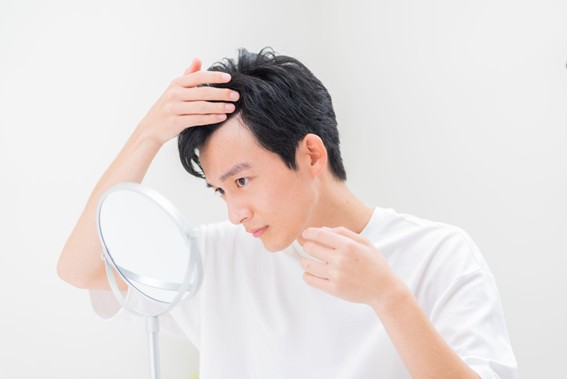 >高校生でもM字はげや薄毛になる